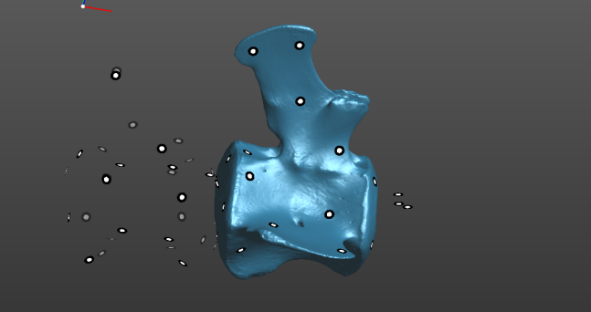 獲取單節(jié)脊椎骨的完整3D數(shù)據(jù)